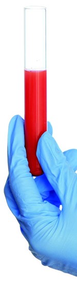 liquid-biopsy liquid-biopsy