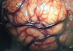 brain-picture brain-picture