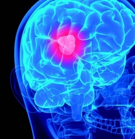 brain-image brain-image