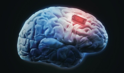 medical-implant medical-implant