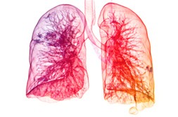 lung lung