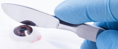 retinal-implants-2138 retinal-implants-2138