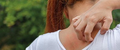 scratching-the-surface-of-severe-itching-18-1603 scratching-the-surface-of-severe-itching-18-1603