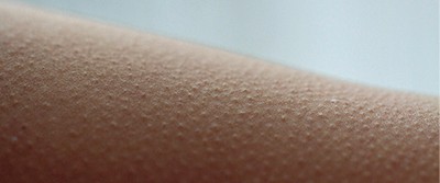goose-bumps-0400 goose-bumps-0400