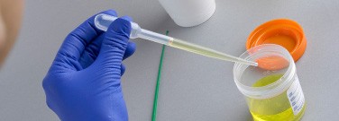 transfer-pipettes