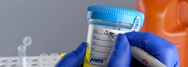 specimen-containers specimen-containers