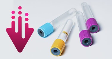 aneuploidy-detection-images-extract-dna aneuploidy-detection-images-extract-dna