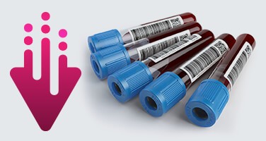 cystic-fibrosis-testing-images-sample-collection cystic-fibrosis-testing-images-sample-collection