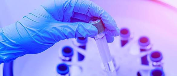 solutions-for-genetic-analysis-centrifuge solutions-for-genetic-analysis-centrifuge