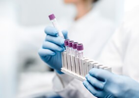 biotin-may-interfere-with-lab-tests-lp-18-226-2806 biotin-may-interfere-with-lab-tests-lp-18-226-2806