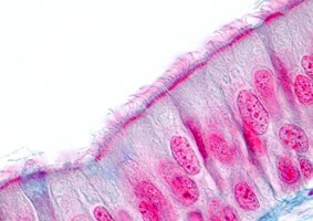 19-324-1621-LND-EprendiaWebinar-lp Tissue Sample
