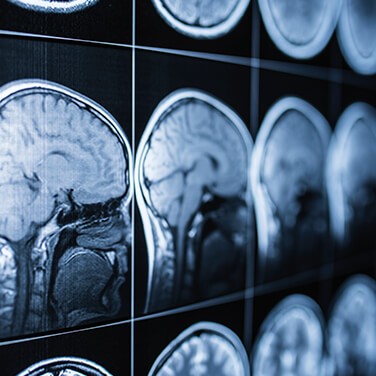 technology-sheds-light-concussions-2034