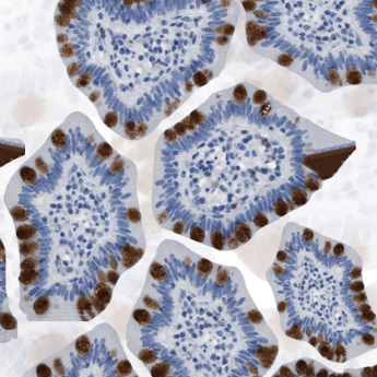 Get 1 Extra Antibody When You Buy 2
